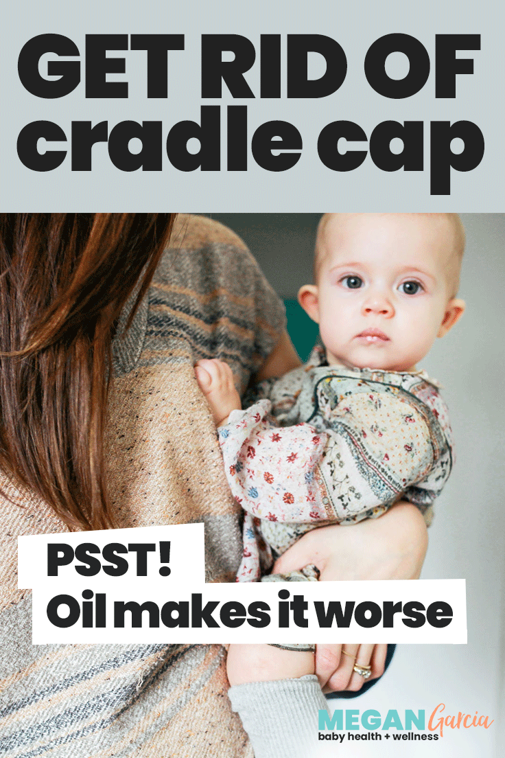 7 month old cradle cap