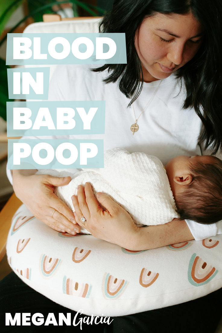 blood-in-baby-poop-what-it-means-megan-garcia