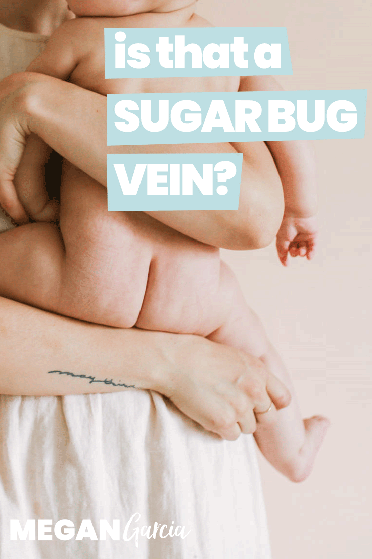 Is That A Sugar Bug Vein On Baby's Nose? | Megan Garcia