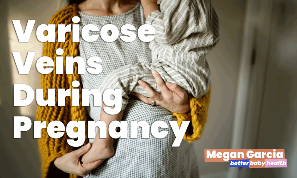 Varicose Veins During Pregnancy | Megan Garcia | Better Baby Health